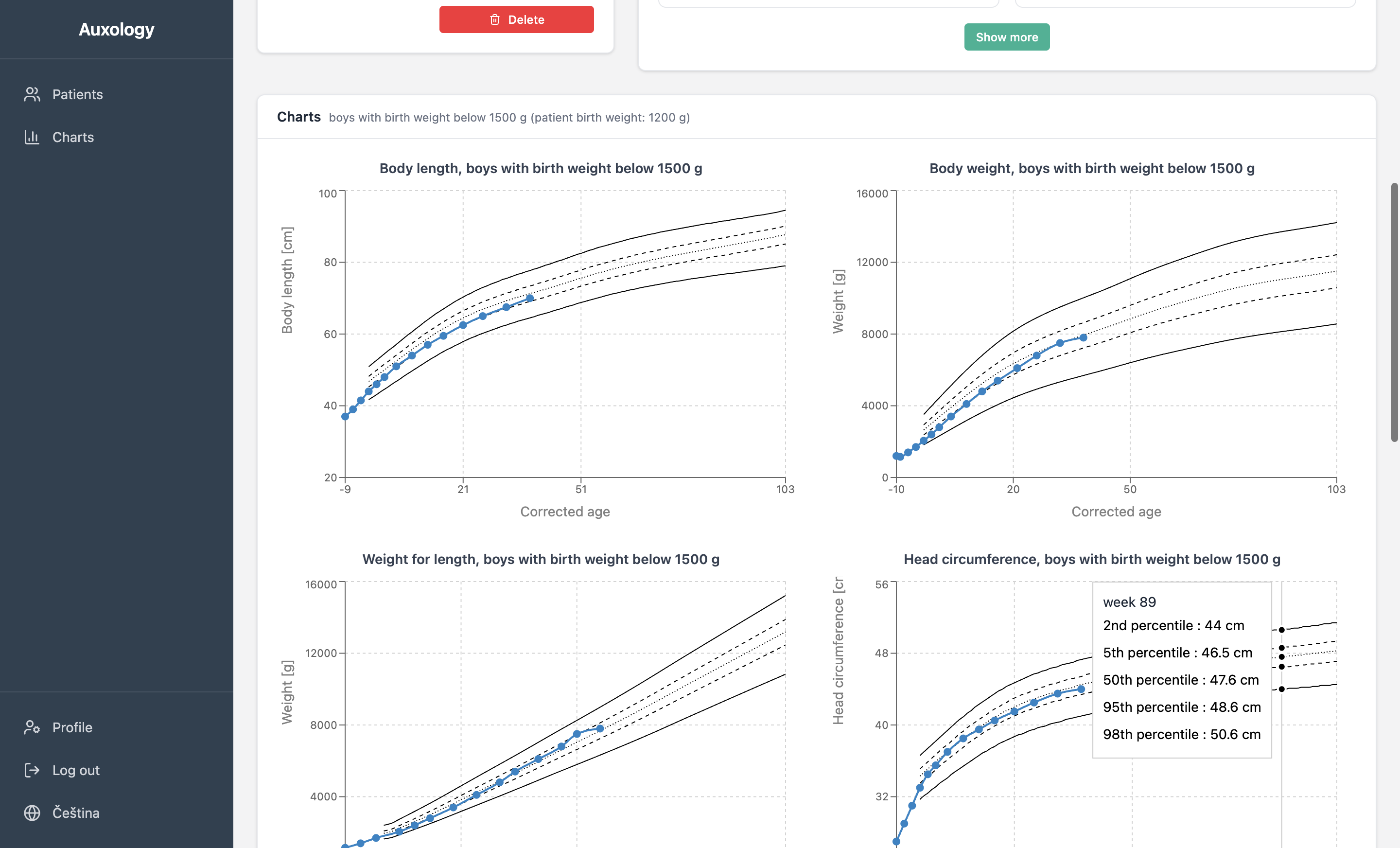 Growth charts with percentile curves